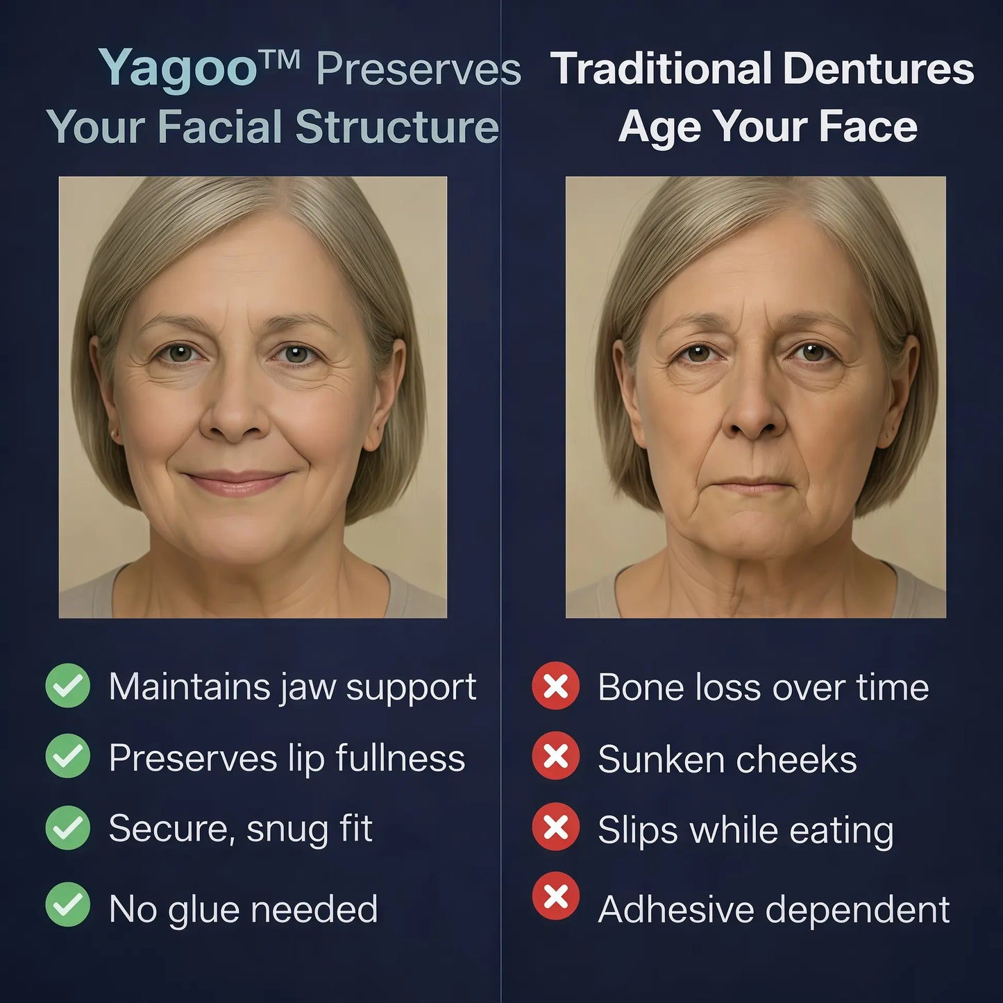Newly upgraded second-generation YagooTM complete dentures