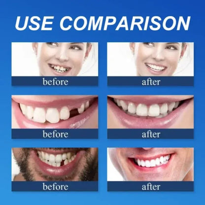 🌎Ends Today: 60% OFF! ⏰ Medical Full Denture with Strong Suctiond🦷Obtain American Dental Association (ADA) Certification