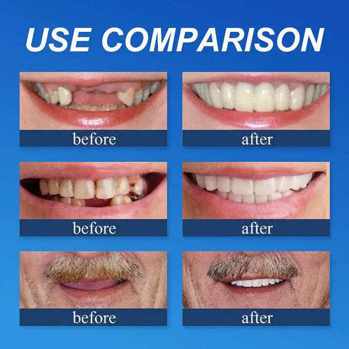 🏆Ends Today: Exclusive Smile Care Offer! 🏆2026 Bestselling Product🦷 Fresh Smile Comfort, Say Goodbye to Wearing Discomfort!🌎